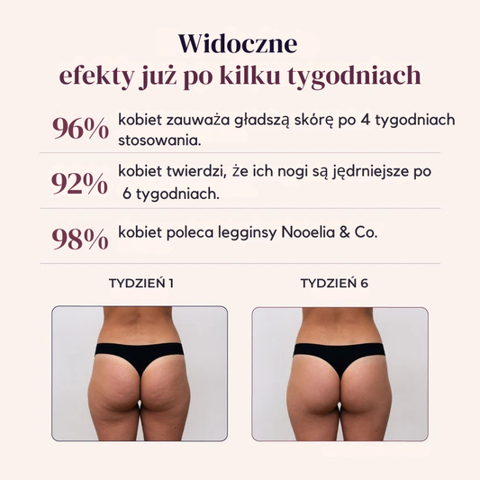 Legginsy modelujące 3D na cellulit