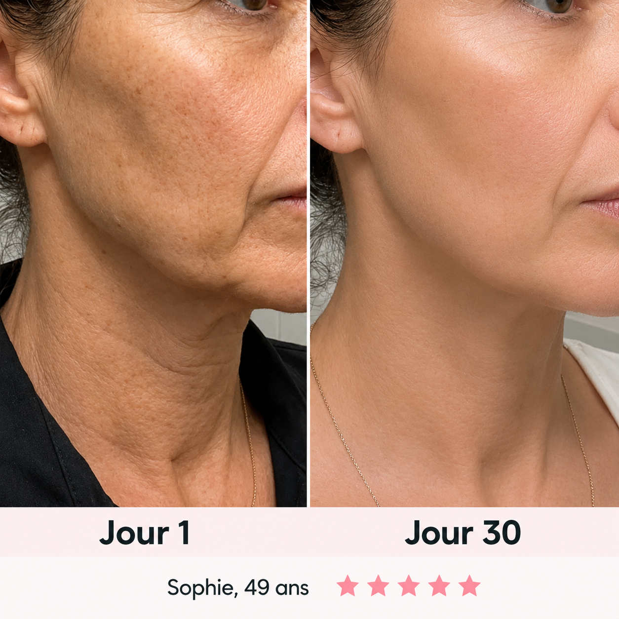 NOVEA™ – Sculpteur Visage Clinic-Tech LED & EMS 7-en-1