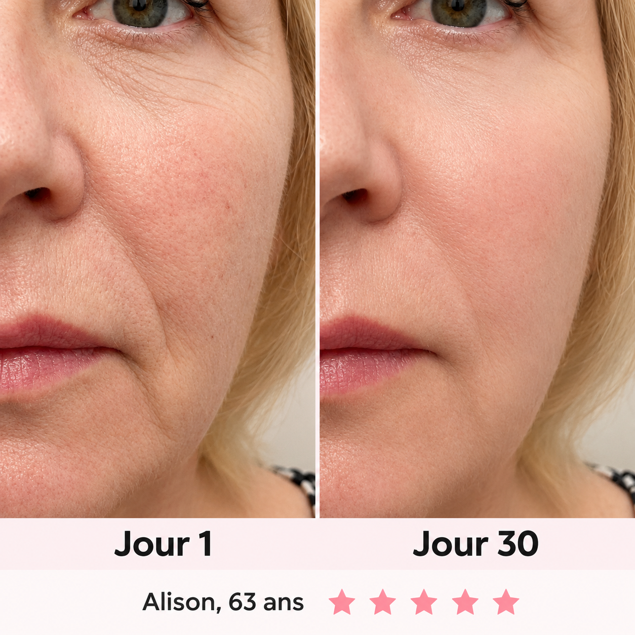 NOVEA™ – Sculpteur Visage Clinic-Tech LED & EMS 7-en-1