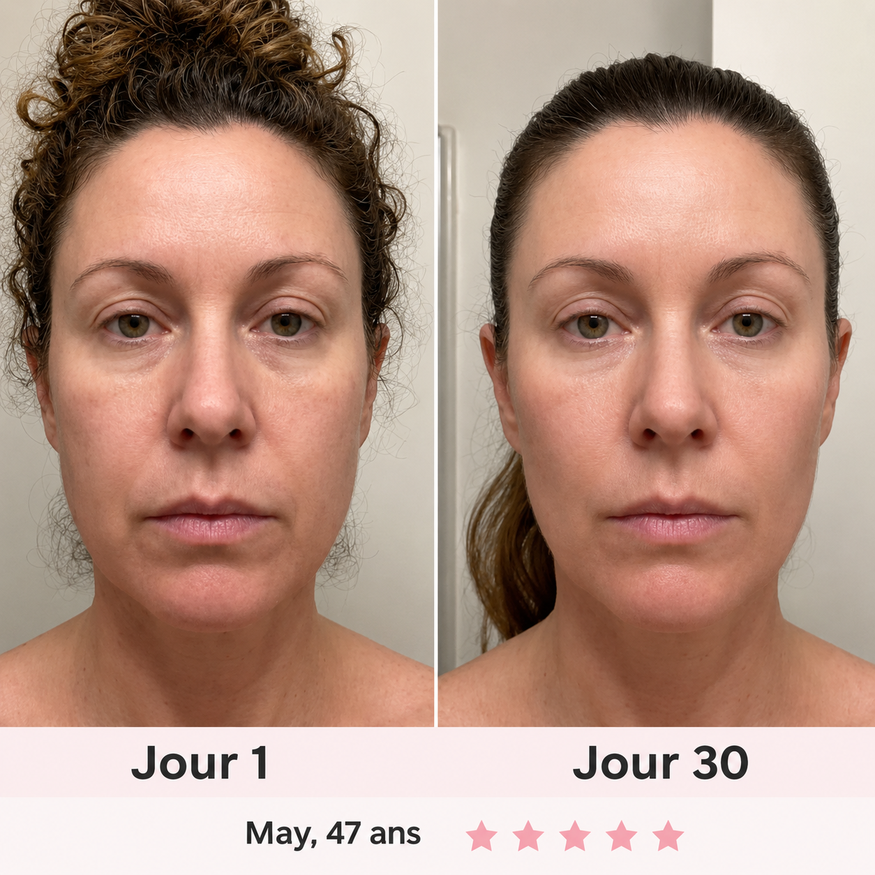 NOVEA™ – Sculpteur Visage Clinic-Tech LED & EMS 7-en-1