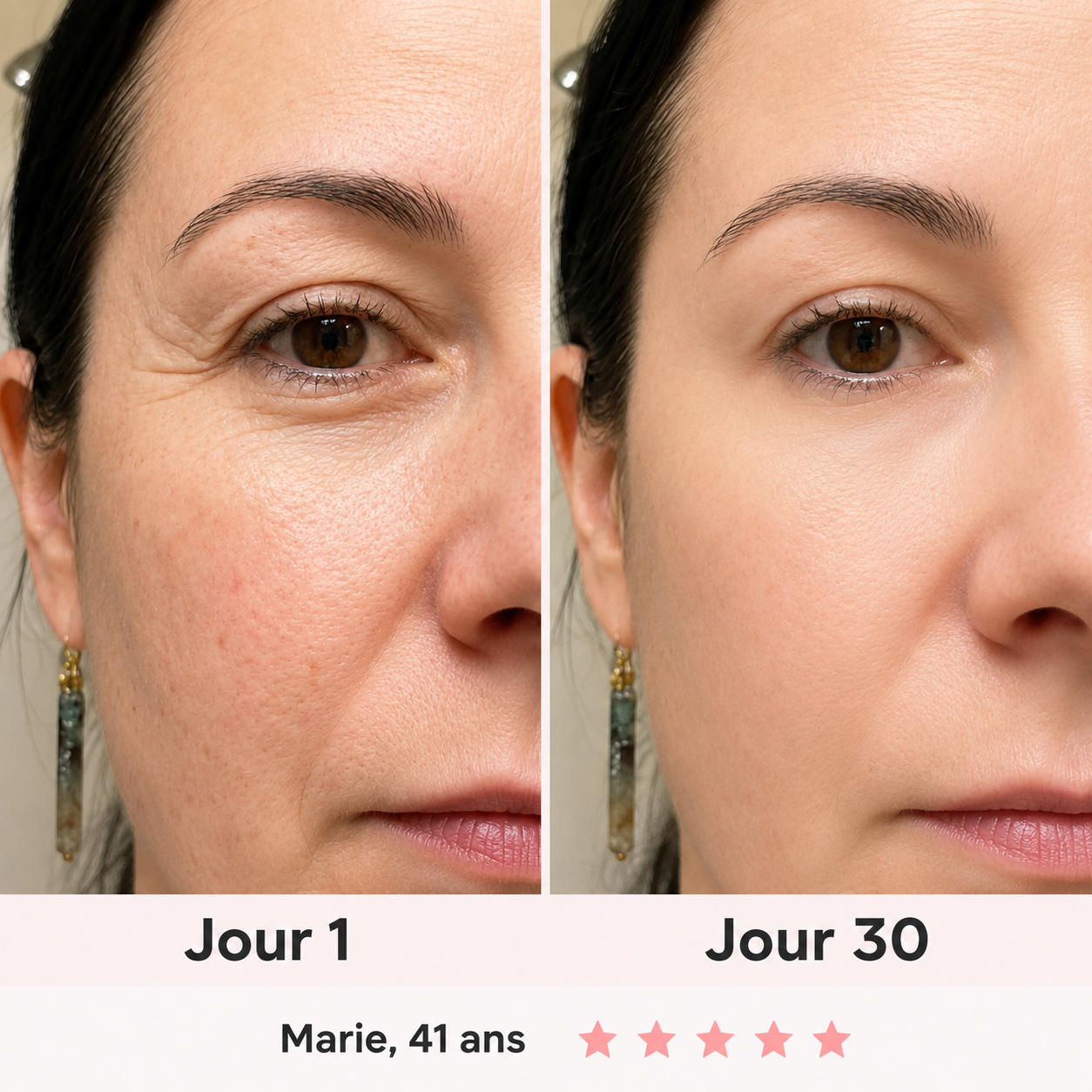 NOVEA™ – Sculpteur Visage Clinic-Tech LED & EMS 7-en-1