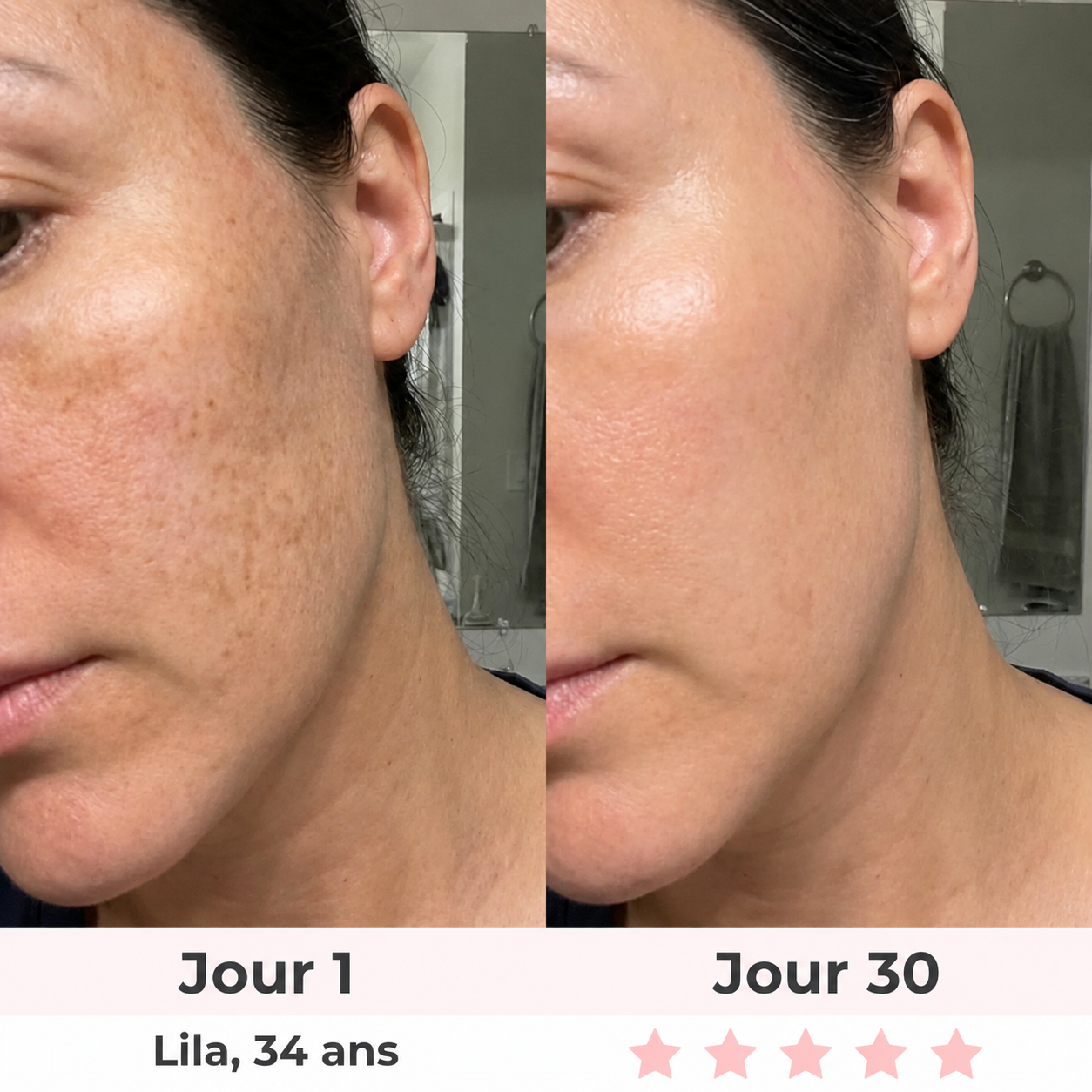 NOVEA™ – Sculpteur Visage Clinic-Tech LED & EMS 7-en-1