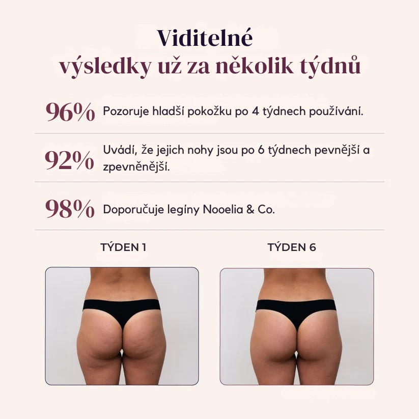 3D tvarující legíny proti celulitidě